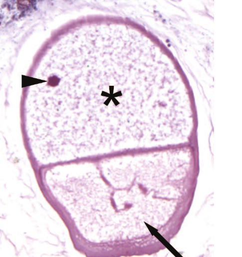 Microscope photo of a single oval gregarine parasite from a hissing cockroach midgut, with labeled body parts